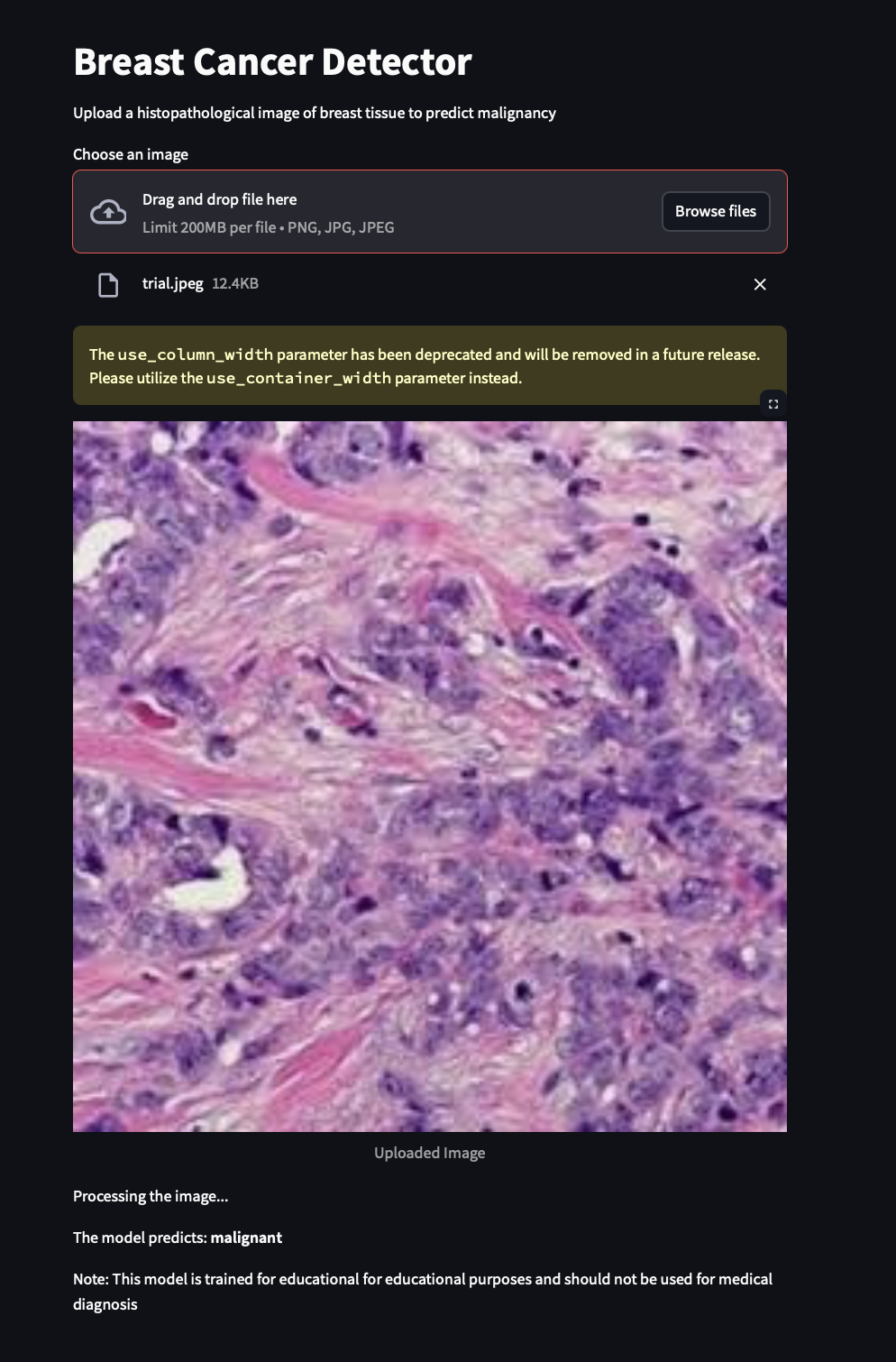 Breast Cancer Detection